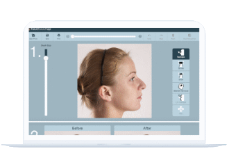 FaceTouchUp For Remote Consultations